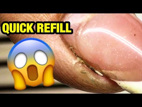 Amazing Transformation! HOW TO QUICK REFILL RUINED GEL NAILS AT HOME?!! NEW NAIL ART 2018
