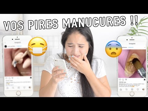 VOS PIRES MANUCURES !!!