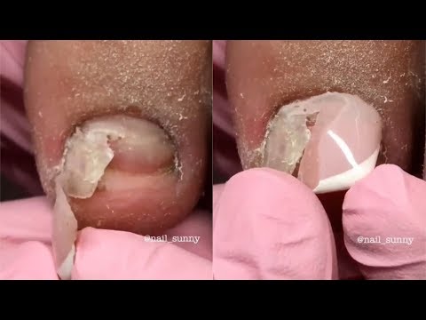 Amazing Toenails Transformations 💄😱Nail Art Designs Compilation 2018